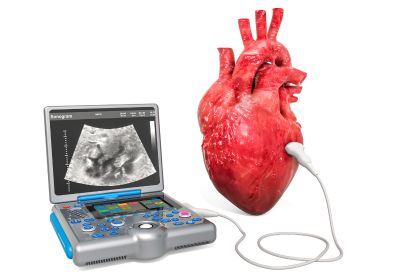 Echocardiograms Echocardiograms