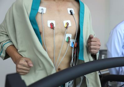 Holter Monitoring Holter Monitoring